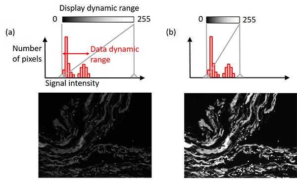 Figure 8 – Display adjustment: (top) a histogram with the display setting indicator in a gray solid vertical line, (bottom) the example image. Left example image: original display setting. Right example image: display condition adjusted while maintaining the original image data.