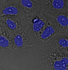 (C) TruAI detection of nuclei positions from the brightfield image