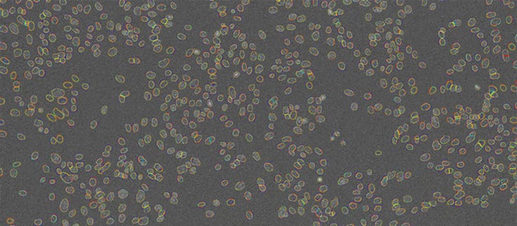 Figure 7 Nuclei contours detected by TruAI at 4 different SNRs shown on top of the image acquired with the lowest light exposure level (0.05%). Contrast optimized for visualization only.