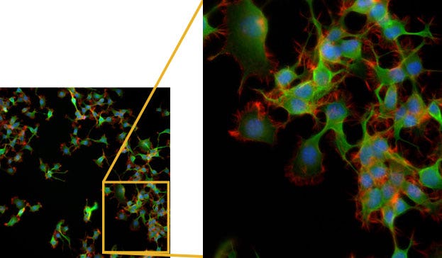 (a) Conventional UPLSAPO20X (NA 0.75)