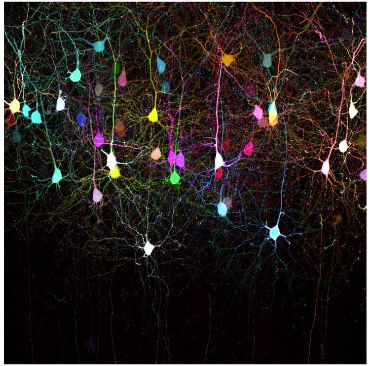 Mouse brain slice captured on the FLUOVIEW FV5000 confocal laser scanning microscope.