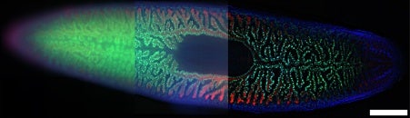 Planarian flatworm imaged with widefield and SILA techniques