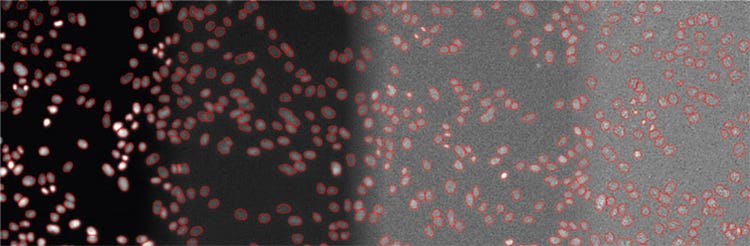 Figure 5 Examples of detected objects by TruAI in images with different SNRs acquired with light exposure levels of (from left to right) 100%, 2%, 0.2%, and 0.05%. Contrast optimized per SNR for visualization only.