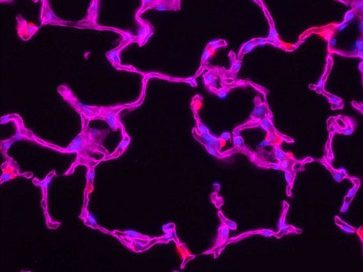 Confocal, Multiphoton, and Super Resolution