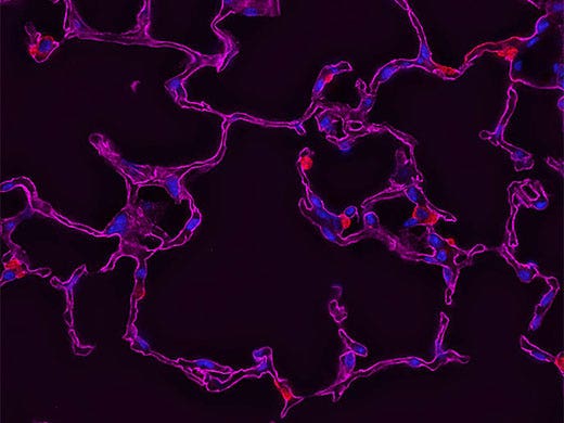 Confocal, Multiphoton, and Super Resolution