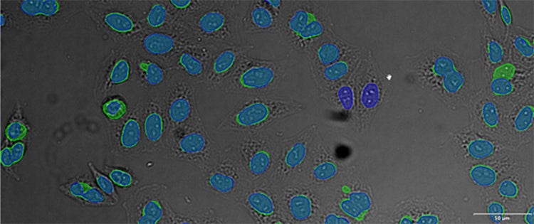 (D) overlay of GFP label (green) and AI result (blue)