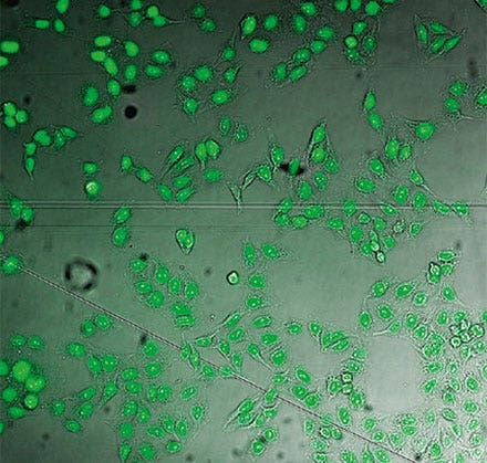 Figure 7 Histone 2B GFP label, highlighting the nucleus, on top of the brightfield image shown in Figure 3. The GFP channel in this case is used to generate the ground truth automatically.