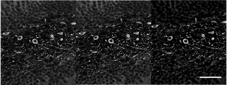 Mouse brain imaged with confocal and SILA techniques