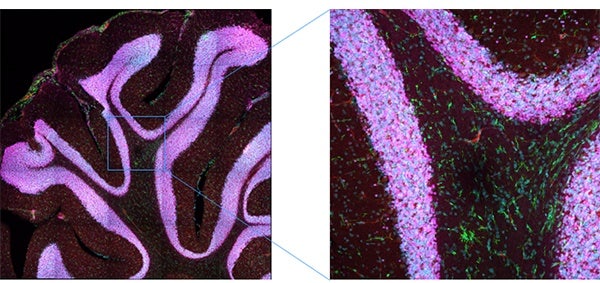 Figure 17. Efficient image acquisition using the SilVIR detector. A maximum intensity projection of stitched Z slice images was acquired using a resonant scanner. Because of the SilVIR detector’s high S/N ratio, a large number of images can be acquired efficiently.