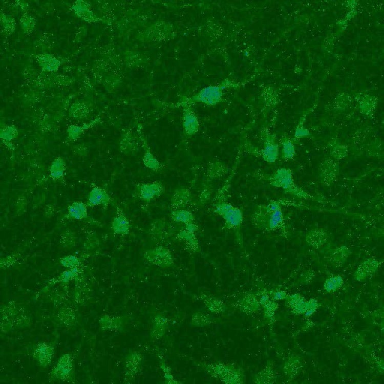 Calcium imaging: chemical indicator Fluo-3 in neuronal cells.