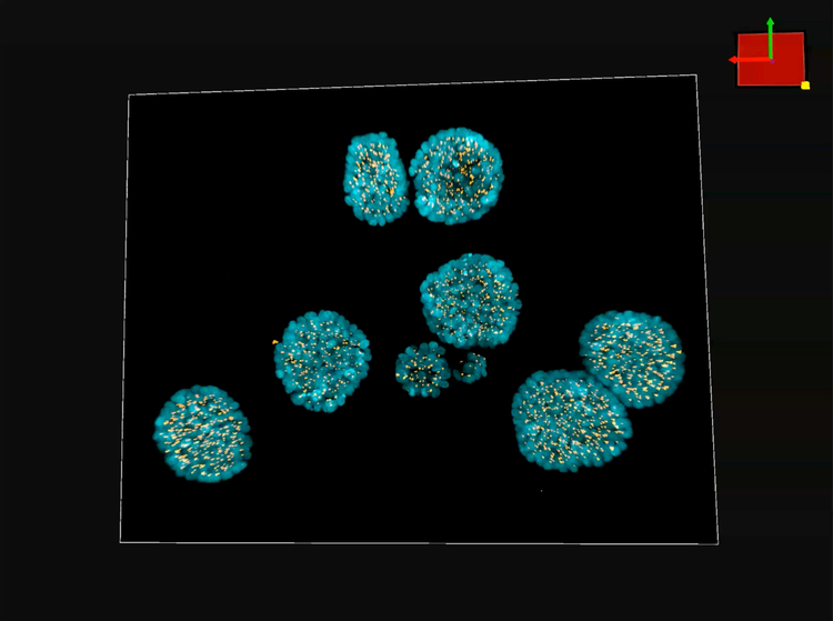 3D epithelial breast cancer spheroids. DAPI (blue), pericentrin (yellow).