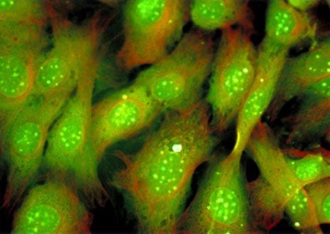 Embryonic Swiss Mouse Fibroblast Cells (3T3)