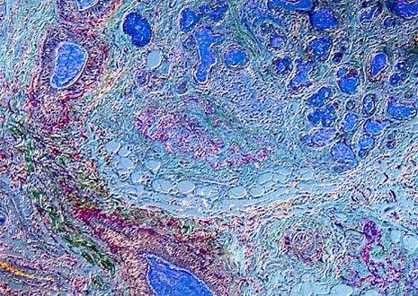 Lung Tissue with Movat Stain