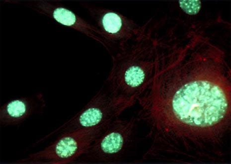 Fibroblast Nuclei