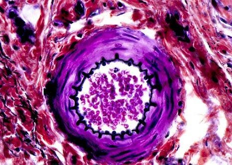 Arteriole Stained Thin Section