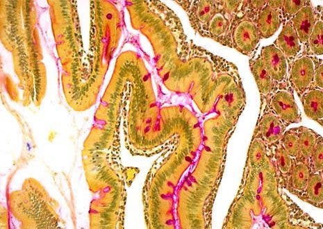 Human Intestinal Tissue