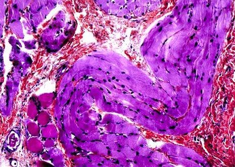 Sycamore Tree (Plantanus occidentalis) Section