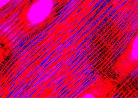 Butternut Tree (Juglans cinerea) Thin Section