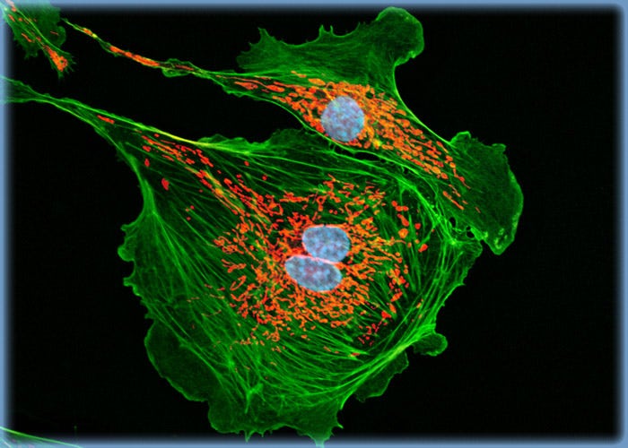 Visualizing F-Actin and Mitochondria in Bovine Pulmonary Artery Endothelial Cells