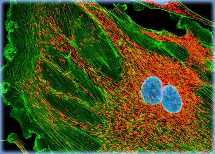 Targeting the Mitochondrial Network and DNA in Cultures of Bovine Pulmonary Artery Endothelial Cells