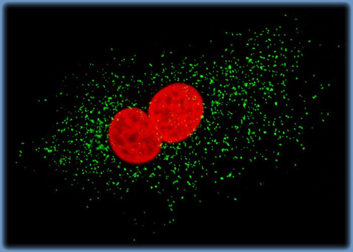 BPAE Cells Immunofluorescently Labeled for Nuclear Histone Proteins and Peroxisomes