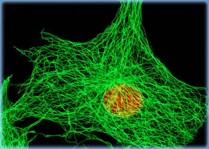 The Microtubule Network in Gerbil Lung Cells