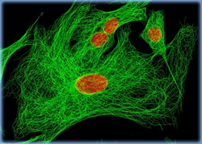 Microtubules Immunofluorescently Visualized in Mongolian Gerbil Lung Fibroblasts