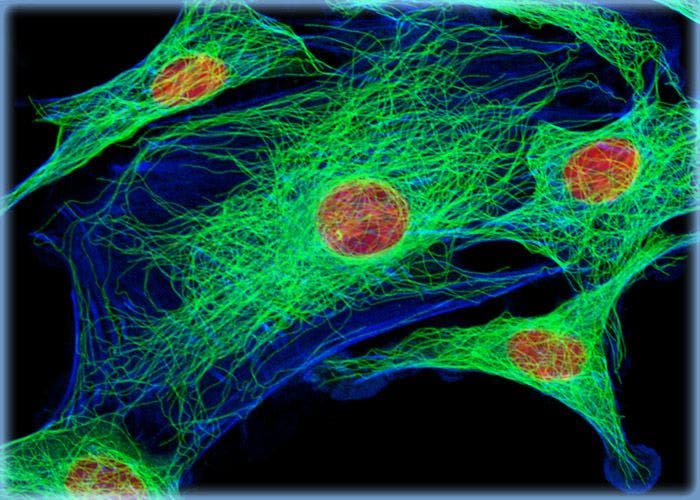 Gerbil Lung Cells Labeled for Tubulin with Immunofluorescence