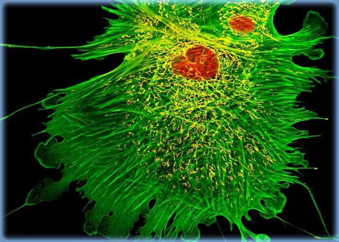 F-Actin and Mitochondria Distribution in HJ1.Ov Cells