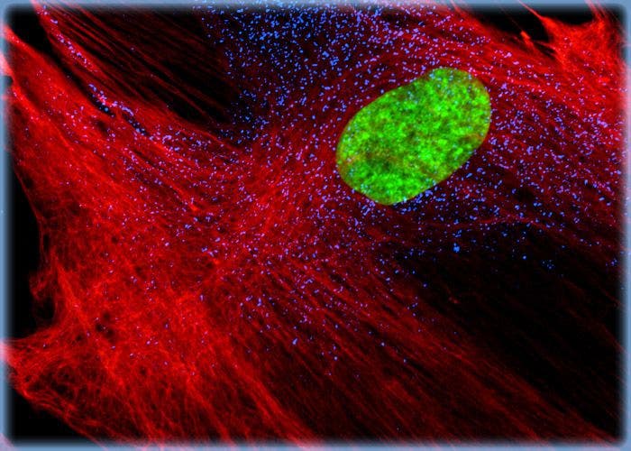 Human Fetal Lung Fibroblast Cells (MRC-5 Line)