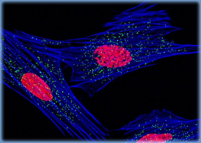 Peroxisome and Histone Protein Distribution in Muntjac Fibroblasts