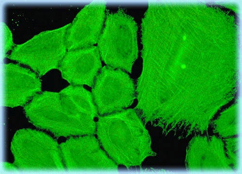 Myosin in A549 Cells