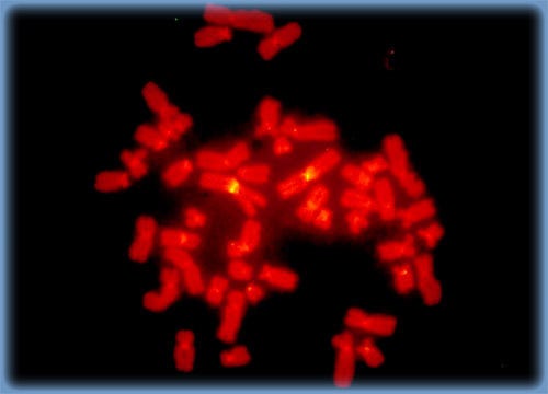 Human Metaphase Chromosome Centromeres