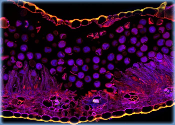 Rust Microspce Corn Rust Microscope Image | Plant Cell Microscopy
