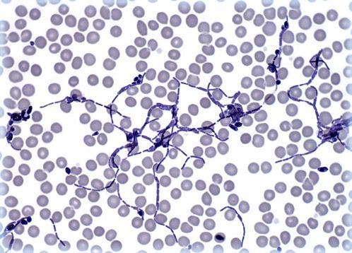 Bacteria, Yeast, and Blood