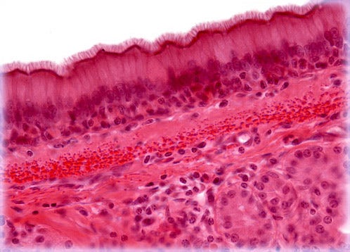 Pseudostratified Ciliated Columnar Epithelium