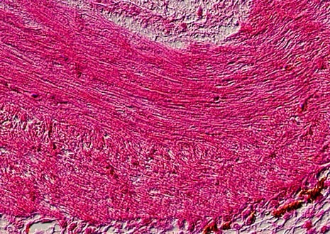 Frog Heart Muscle Tissues