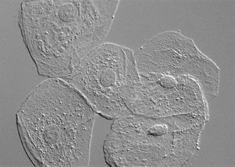 Human Cheek Epithelial Cells