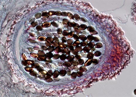 Fungus (Sordaria fimicola) Fruiting Bodies