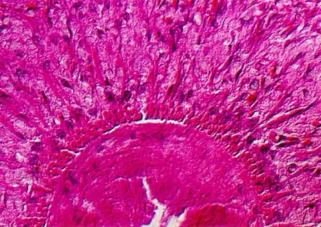 Planaria Cross Section