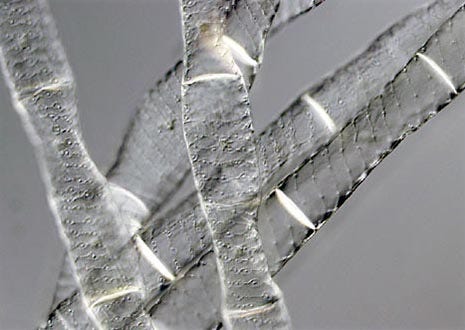 Spirogyra Filamentous Algae