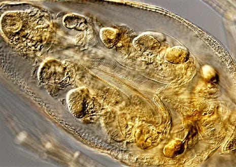 Water Flea (Daphnia)