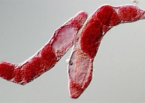 Trematode (Fasciolopsis buski) Rediae