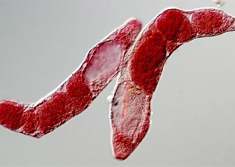 Trematode (Fasciolopsis buski) Rediae | Evident Scientific