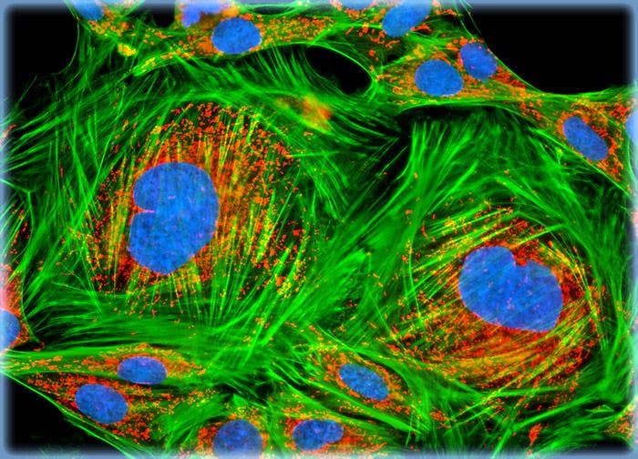 Rat Kidney Mesangial Cells (RMC Line)