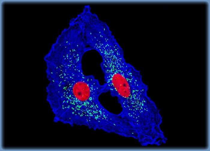 Human Brain Glioma Cells (U-118 MG Line)