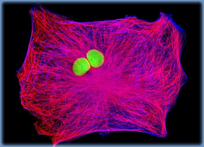 Normal African Green Monkey Kidney Epithelial Cells (Vero)