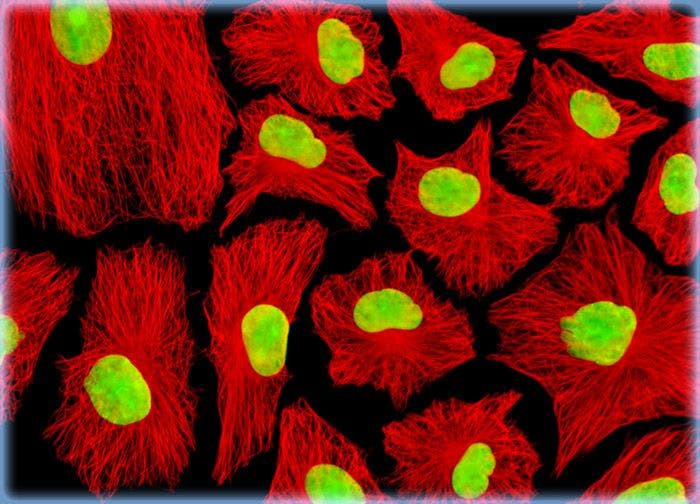 Normal African Green Monkey Kidney Epithelial Cells (Vero)