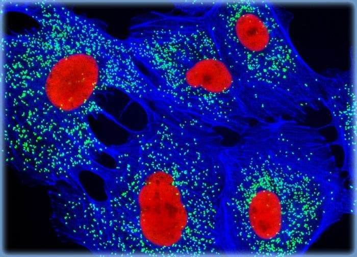 Normal African Green Monkey Kidney Epithelial Cells (Vero)