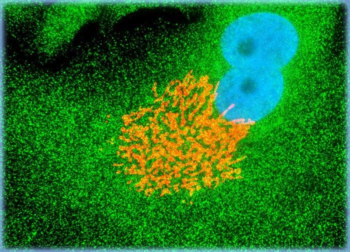 Normal African Green Monkey Kidney Epithelial Cells (Vero)